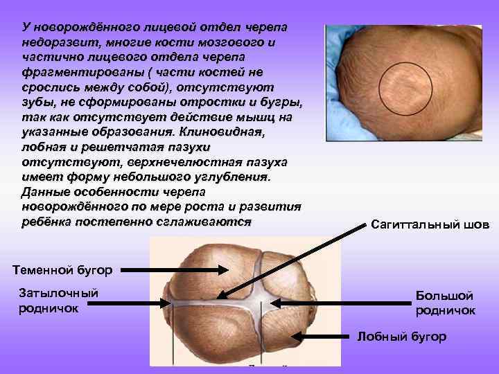 У новорождённого лицевой отдел черепа недоразвит, многие кости мозгового и частично лицевого отдела черепа