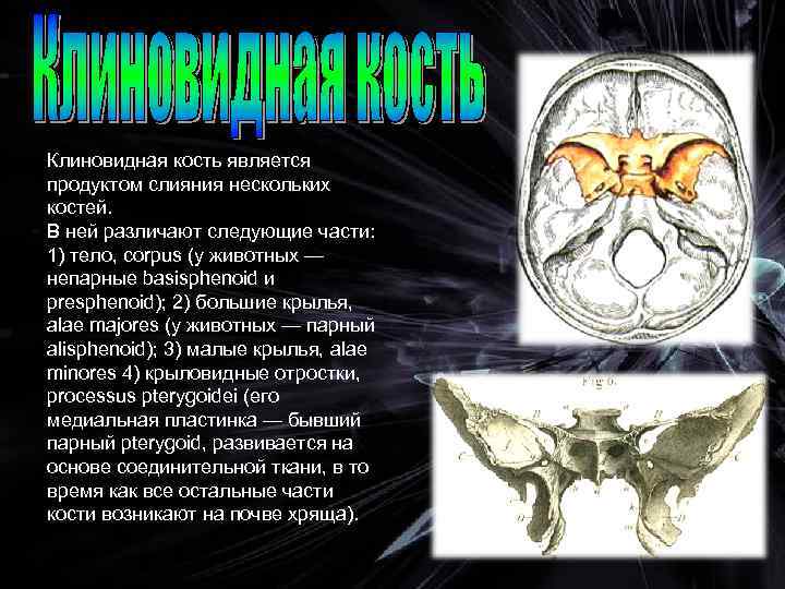 Кт анатомия черепа. Крыло клиновидной кости на кт. Клиновидная кость черепа анатомия на кт.