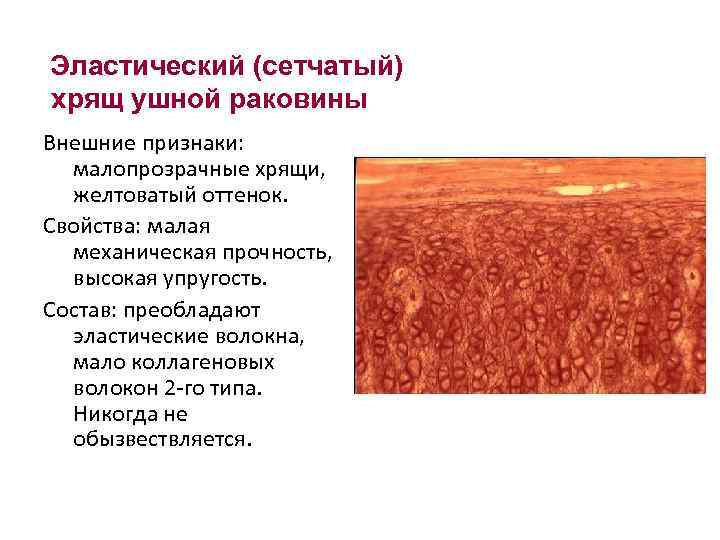 Функция хрящей в организме человека. Эластический хрящ гистология орсеин. Коллагеновые и эластические волокна в хрящах. Эластическая (сетчатая) хрящевая ткань;. Эластические волокна в эластическом хряще.