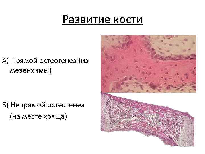 Схема непрямого остеогенеза гистология