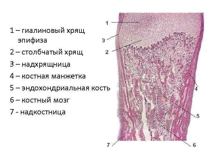 Развитие кости на месте хряща гистология рисунок