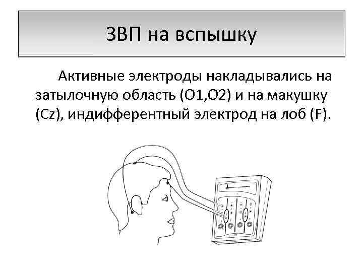 Моторные вызванные потенциалы