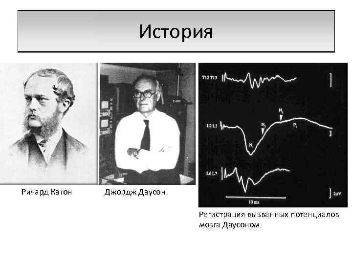 История Ричард Катон Джордж Даусон Регистрация вызванных потенциалов мозга Даусоном 