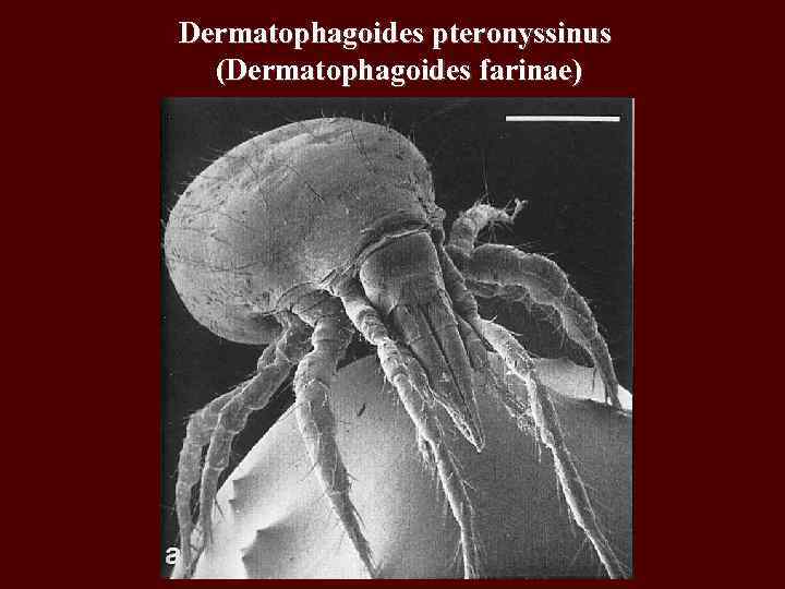 Dermatophagoides pteronyssinus (Dermatophagoides farinae) 