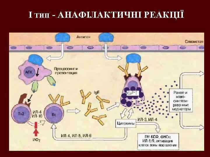 І тип - АНАФІЛАКТИЧНІ РЕАКЦІЇ 