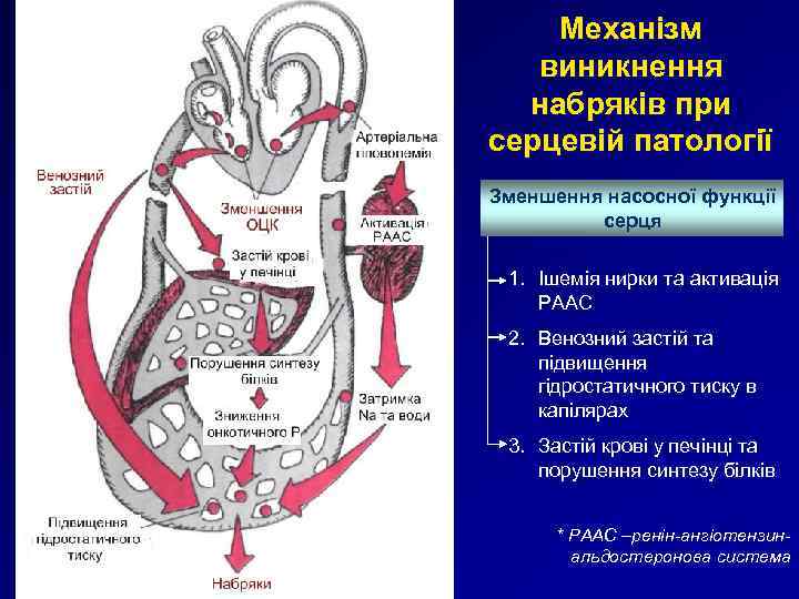 Механізм виникнення набряків при серцевій патології Зменшення насосної функції серця 1. Ішемія нирки та