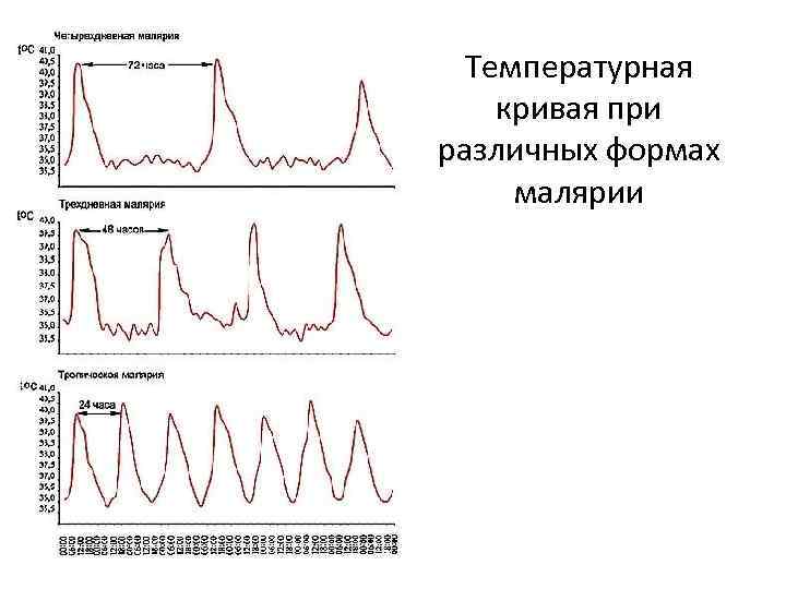 Температурная кривая при различных формах малярии 