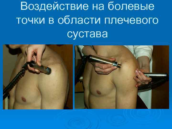 Воздействие на болевые точки в области плечевого сустава 