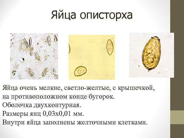 Яйца описторха Яйца очень мелкие, светло-желтые, с крышечкой, на противоположном конце бугорок. Оболочка двухконтурная.
