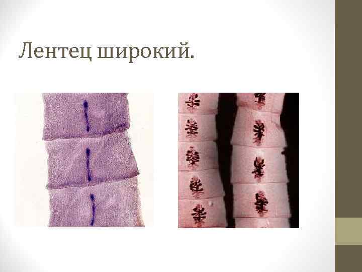 Лентец широкий. 