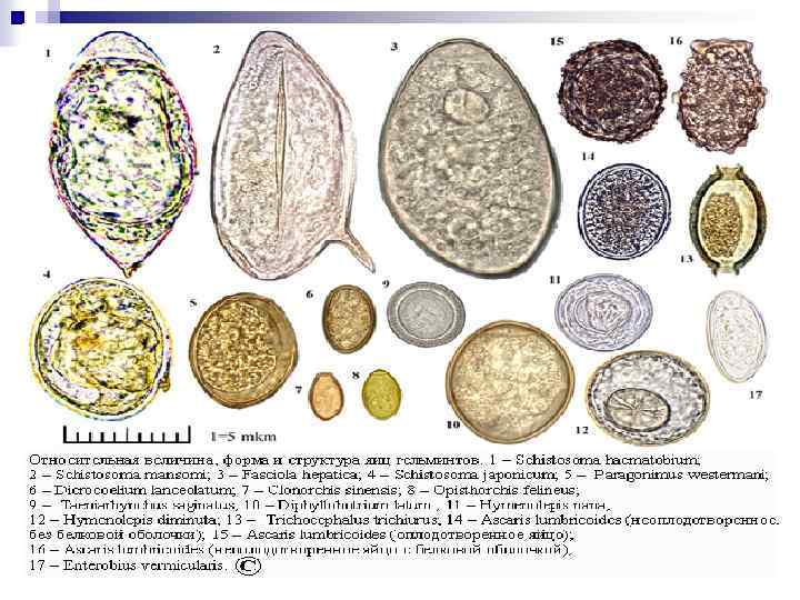 Яйца описторха в кале под микроскопом фото
