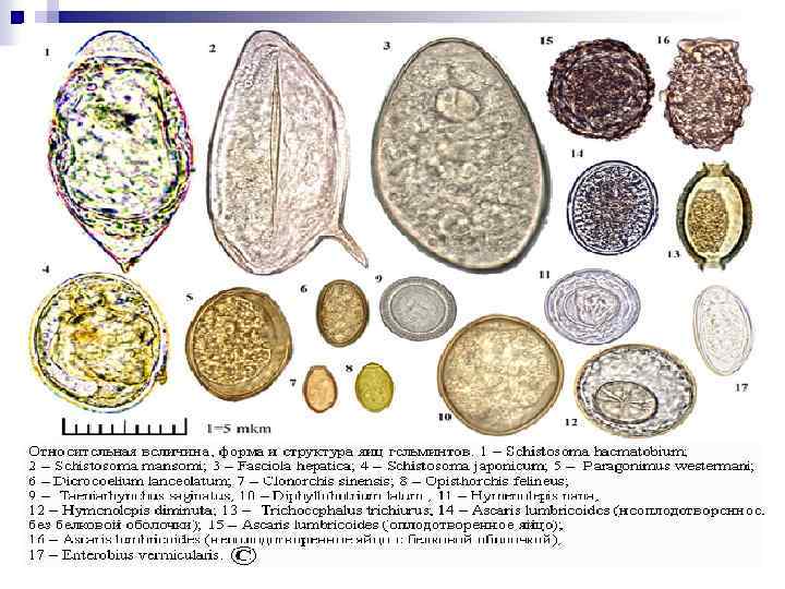 Яйца гельминтов фото в натуральную величину