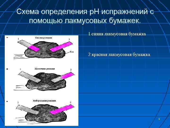 Схема определения р. Н испражнений с помощью лакмусовых бумажек. 1 синяя лакмусовая бумажка 2