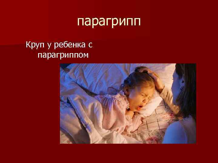 парагрипп Круп у ребенка с парагриппом 