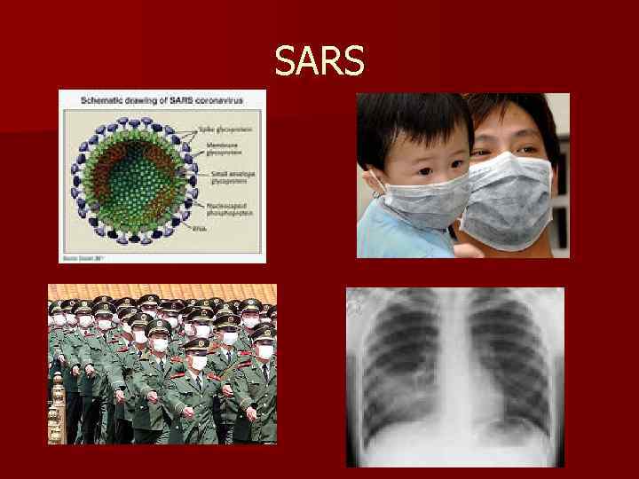 SARS 