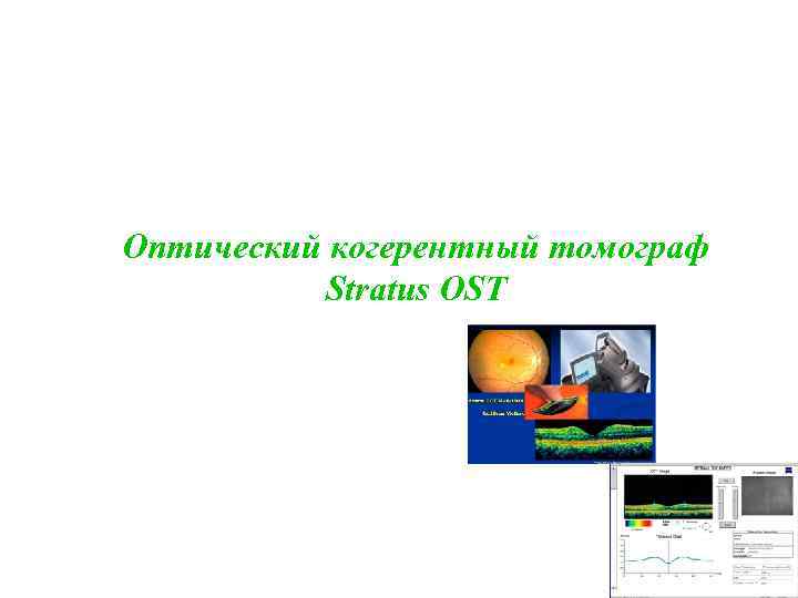 Оптический когерентный томограф Stratus OST 