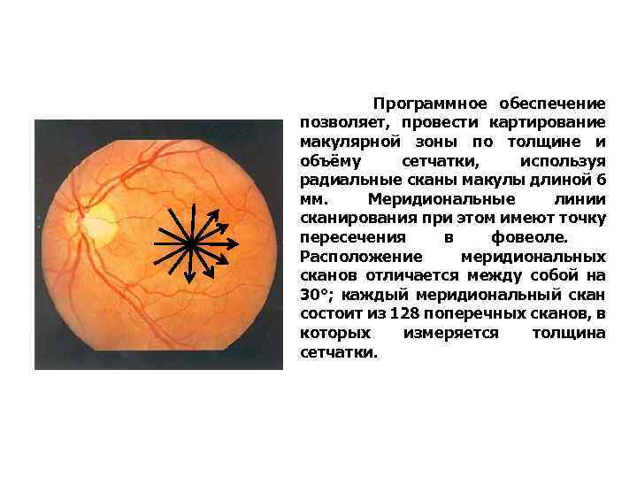 Программное обеспечение позволяет, провести картирование макулярной зоны по толщине и объёму сетчатки, используя радиальные