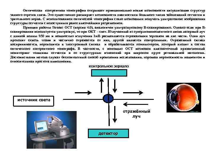 Оптическая когерентная томография открывает принципиально новые возможности визуализации структур заднего отрезка глаза. Это существенно