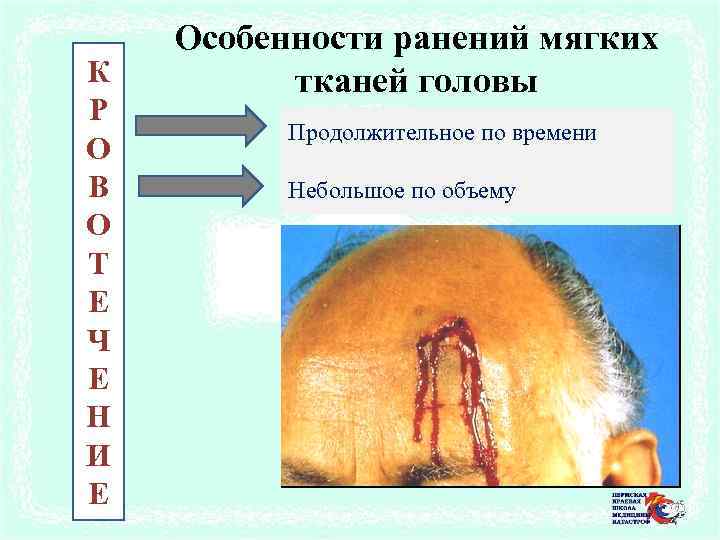 К Р О В О Т Е Ч Е Н И Е Особенности ранений