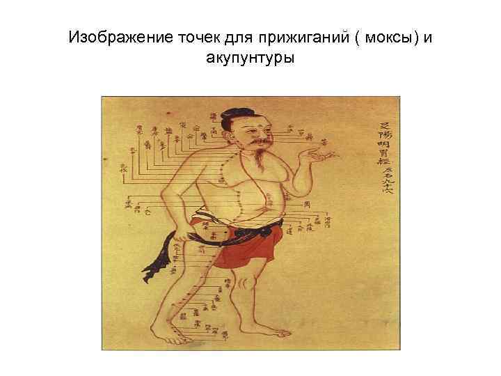 Изображение точек для прижиганий ( моксы) и акупунтуры 