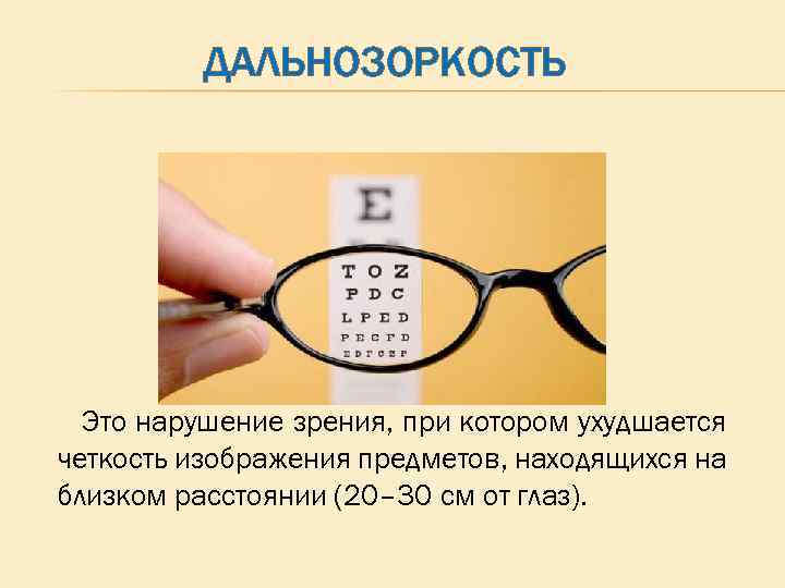 ДАЛЬНОЗОРКОСТЬ Это нарушение зрения, при котором ухудшается четкость изображения предметов, находящихся на близком расстоянии