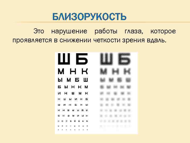 БЛИЗОРУКОСТЬ Это нарушение работы глаза, которое проявляется в снижении четкости зрения вдаль. 