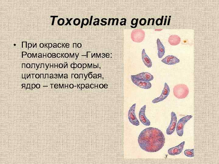 Toxoplasma gondii • При окраске по Романовскому –Гимзе: полулунной формы, цитоплазма голубая, ядро –