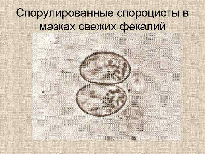 Спорулированные спороцисты в мазках свежих фекалий 