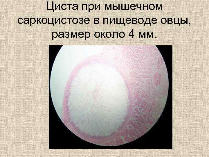 Циста при мышечном саркоцистозе в пищеводе овцы, размер около 4 мм. 