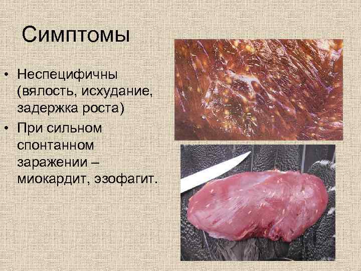 Симптомы • Неспецифичны (вялость, исхудание, задержка роста) • При сильном спонтанном заражении – миокардит,