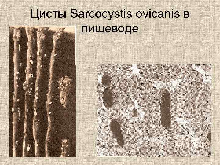 Цисты Sarcocystis ovicanis в пищеводе 