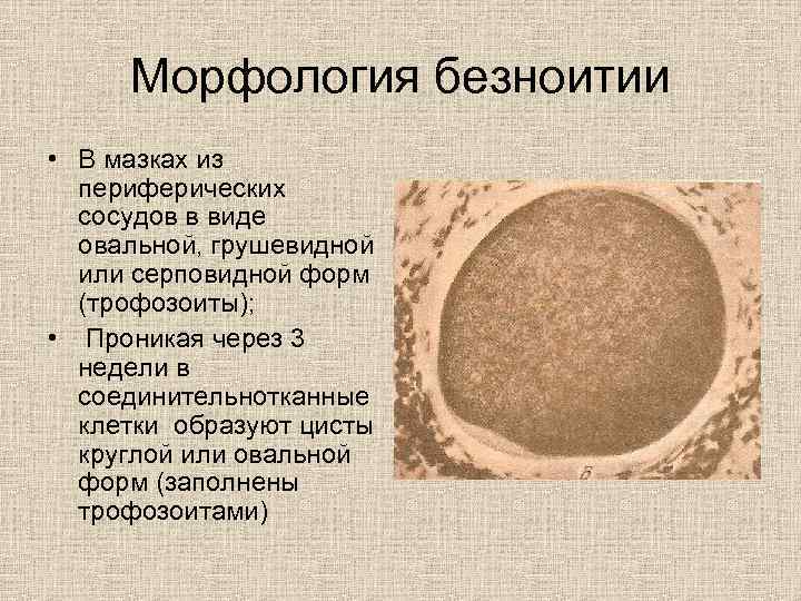 Морфология безноитии • В мазках из периферических сосудов в виде овальной, грушевидной или серповидной