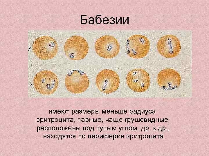 Бабезии имеют размеры меньше радиуса эритроцита, парные, чаще грушевидные, расположены под тупым углом др.