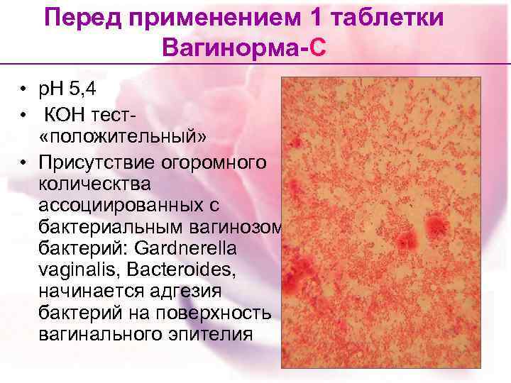 Перед применением 1 таблетки Вагинорма-С • р. Н 5, 4 • КОН тест- «положительный»