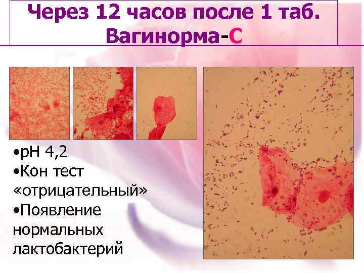 Через 12 часов после 1 таб. Вагинорма-С • р. Н 4, 2 • Кон