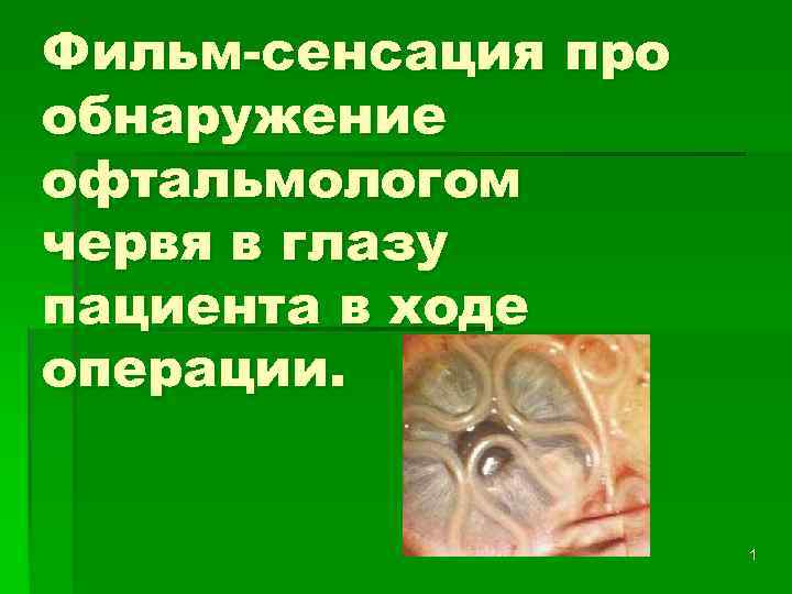 Фильм-сенсация про обнаружение офтальмологом червя в глазу пациента в ходе операции. 1 