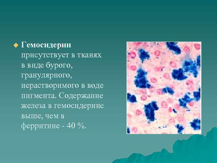 u Гемосидерин присутствует в тканях в виде бурого, гранулярного, нерастворимого в воде пигмента. Содержание