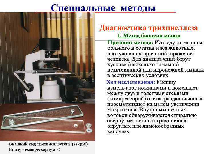 Специальные методы Диагностика трихинеллеза 1. Метод биопсии мышц Принцип метода: Исследуют мышцы больного и