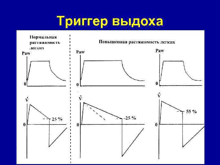 Триггер выдоха 