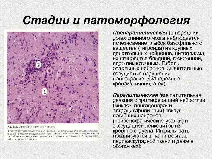 Клетка с базофильной цитоплазмой