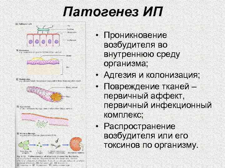 Патогенез ИП • Проникновение возбудителя во внутреннюю среду организма; • Адгезия и колонизация; •