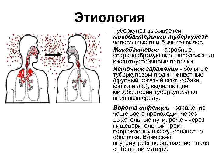 Этиология Туберкулез вызывается микобактериями туберкулеза человеческого и бычьего видов. Микобактерии - аэробные, споронеобразующие, неподвижные