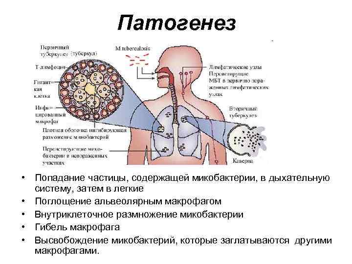Патогенез • Попадание частицы, содержащей микобактерии, в дыхательную систему, затем в легкие • Поглощение