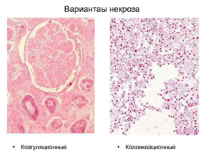 2 что такое апоптоз клетки и какого его биологическое значение