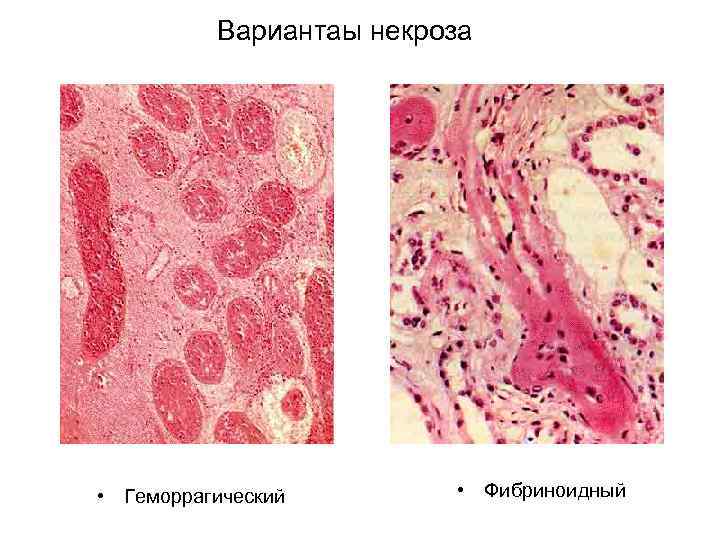 2 что такое апоптоз клетки и какого его биологическое значение