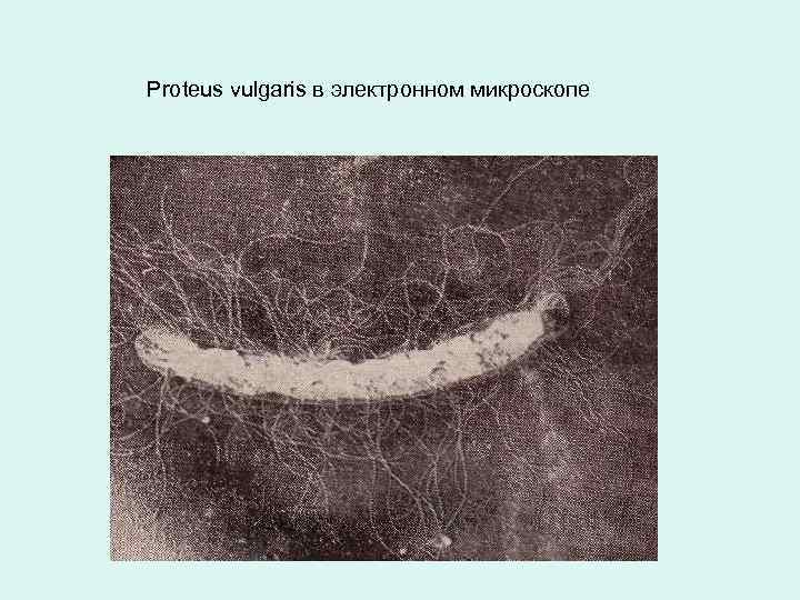 Proteus vulgaris в электронном микроскопе 