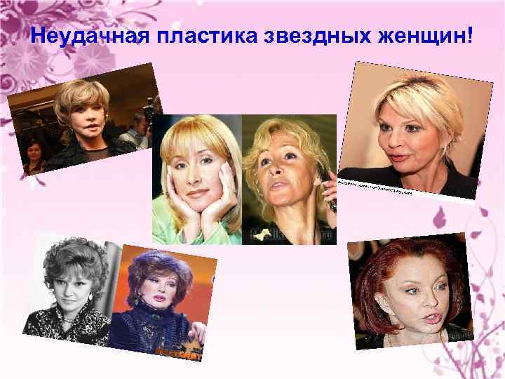 Неудачная пластика звездных женщин! 
