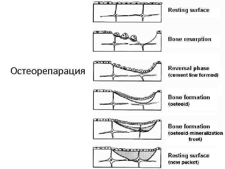 Остеорепарация 