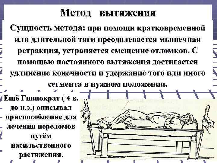 Метод вытяжения Сущность метода: при помощи кратковременной или длительной тяги преодолевается мышечная ретракция, устраняется