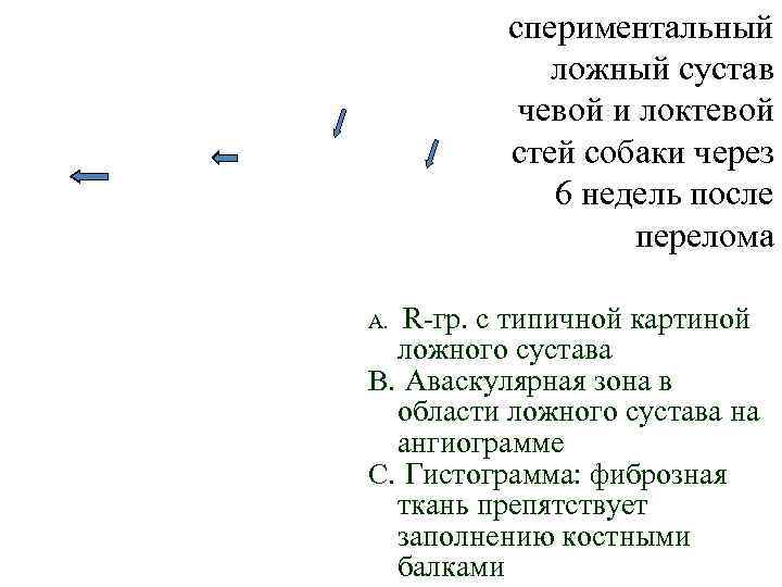 Экспериментальный ложный сустав лучевой и локтевой костей собаки через 6 недель после перелома R-гр.